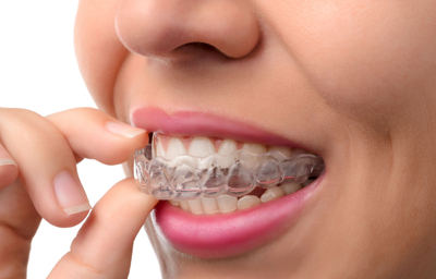 Six Easy Ways To Clean and Take Care of Your Invisalign | Pasadena CA