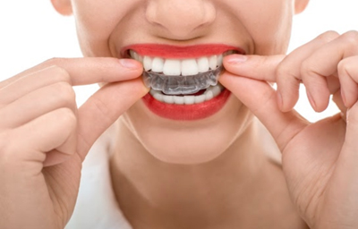 What Problems Can Invisalign Fix?