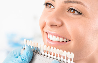 What To Expect After a Teeth Whitening Treatment? | Pasadena, CA