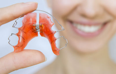 Why I Need To Wear Retainers after Braces?