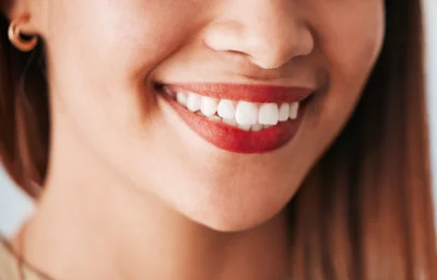 Best and Worst Foods After Teeth Whitening in Pasadena Best and Worst Foods After Teeth Whitening in Pasadena