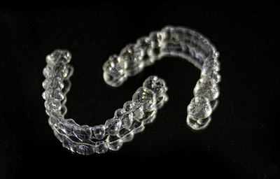 Can Invisalign Be Used After Dental Implant? Can Invisalign Be Used After Dental Implant?
