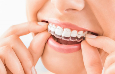 Can Invisalign Treatment Close Gaps? | Pasadena CA