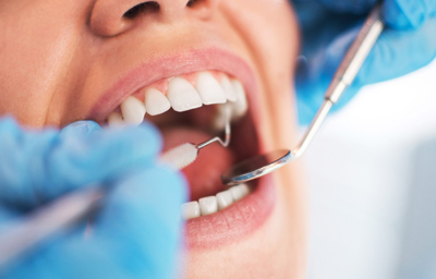 How to know if you need a filling or a root canal? | Pasadena CA