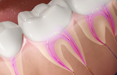 Throwing Lights on Root Canals Treatment
