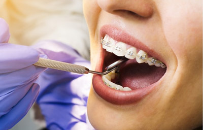 What Does An Orthodontist Do?