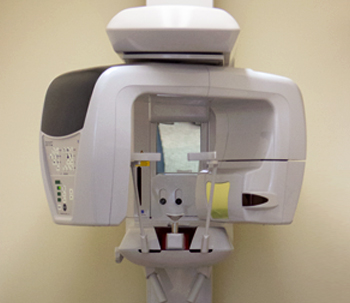 CBCT