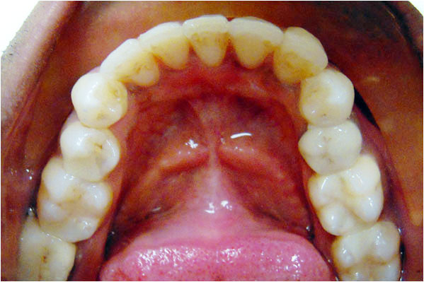 Orthodontics After 